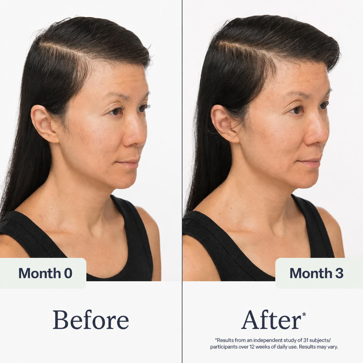 Folifine™ Scalp Density Serum